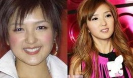 整容女星爆料视频播放,爆料视频背后的惊人真相