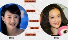 整容女星爆料视频播放,爆料视频背后的惊人真相